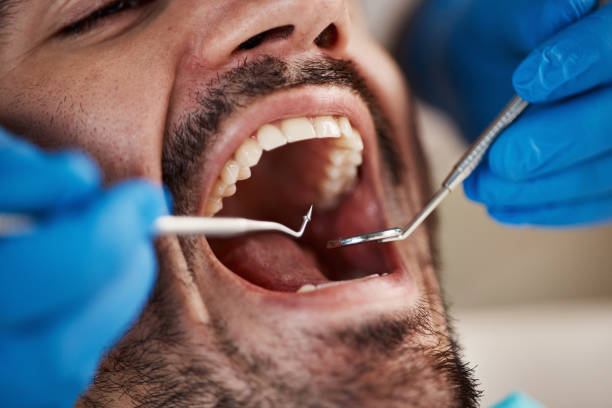 Best Emergency Treatment for Oral Infections in Mableton, GA